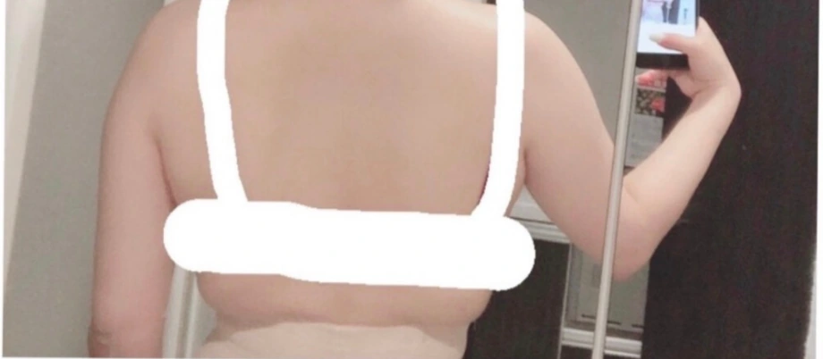 30代・女性・看護師の身体づくりを、新しい挑戦へ・Before