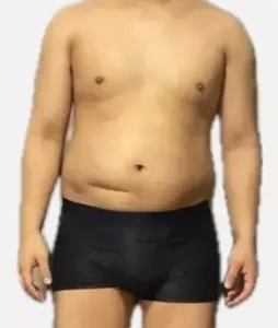 H・M様の首から下・上半身の比較・Before