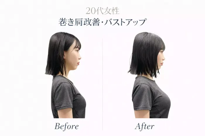旧サイトに掲載された20代女性の横姿勢の比較記録